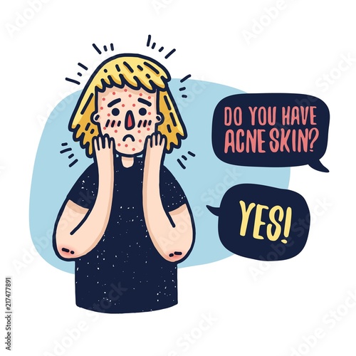 Design banner with cute teen girl about problem skin. Young woman with acne. Template  illustration about dermatological problems. A cartoon female character with pimples and irritation skin. Vector