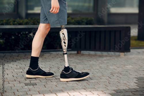 Disabled young man with foot prosthesis walks along the street. photo