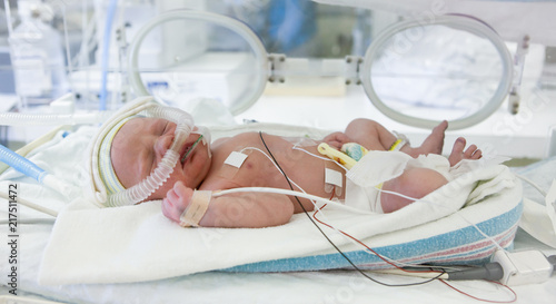 premature newborn baby in incubator