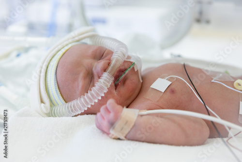 premature newborn baby in incubator