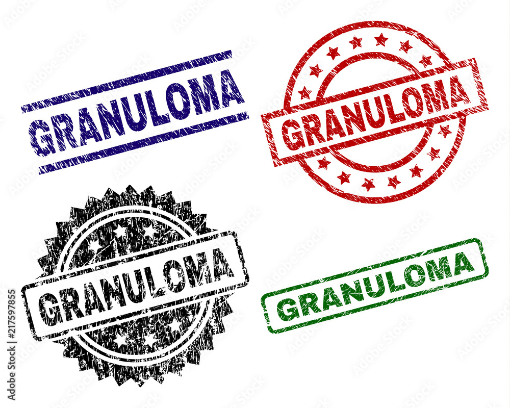 GRANULOMA seal prints with damaged style. Black, green,red,blue vector rubber prints of GRANULOMA text with dirty style. Rubber seals with circle, rectangle, medal shapes. GRANULOMA seal prints with damaged style. Black, green,red,blue vector rubber prints of GRANULOMA text with dirty style. Rubber seals with circle, rectangle, medal shapes.