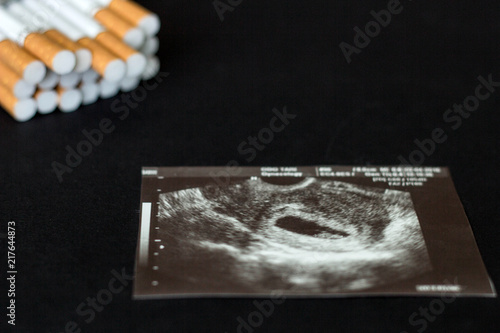 A pack of cigarettes and a photograph of a pregnancy uzi on a black background, pregnancy and smoking, cigarette