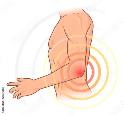 Elbow pain