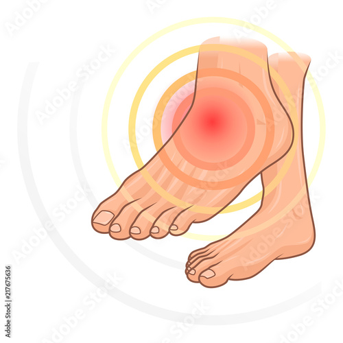 Feet pain