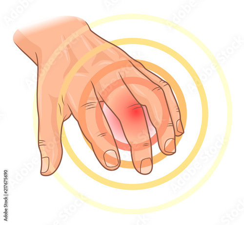 Finger pain