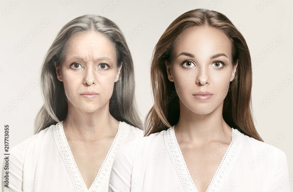 Comparison. Portrait of beautiful woman with problem and clean skin, aging and youth concept, beauty treatment and lifting. Before and after concept. Youth, old age. Process of aging and rejuvenation Comparison. Portrait of beautiful woman with problem and clean skin, aging and youth concept, beauty treatment and lifting. Before and after concept. Youth, old age. Process of aging and rejuvenation