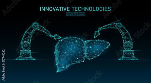 Robotic liver surgery low poly. Polygonal hepatitis surgery procedure. Robot arm manipulator. Modern innovative medicine science automation technology. Triangle 3D render shape vector illustration