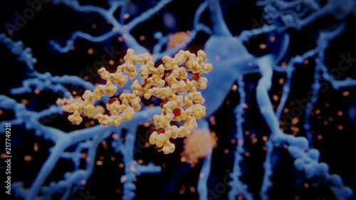 Alzheimer: Freie Amyloid-beta-Peptide lagern sich zu Amyloid-Plaques ab. 