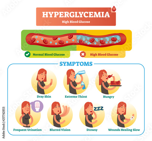 Hyperglycemia vector illustration collection set. Isolated symptom, diagnosis and signs as warning to disease and disorder. High blood sugar. photo