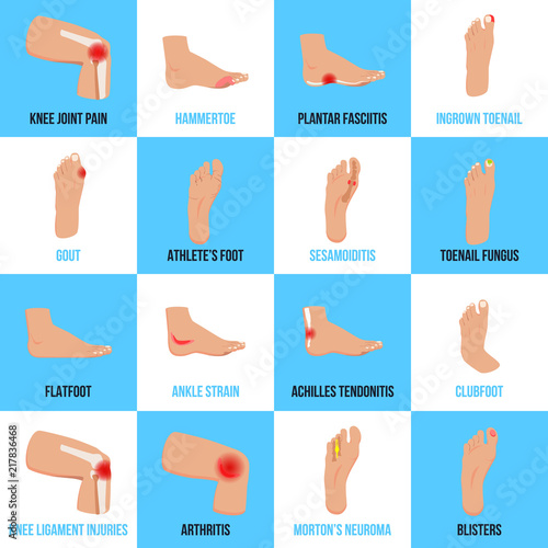 Foot Problems Flat Icons Set
