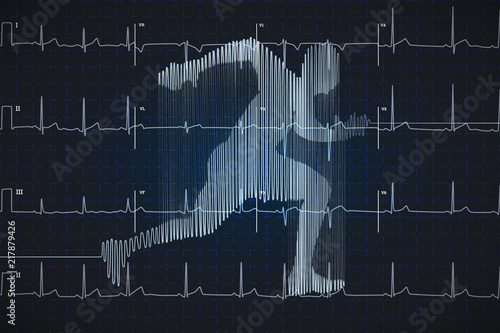 Bright blue human electrocardiogram in running shape on dark monitor, healthy life concept