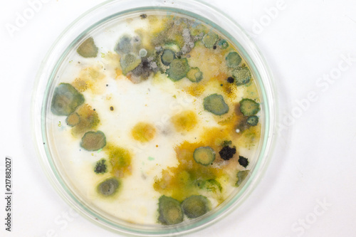 Backgrounds of Colony Characteristics of Fungus and algae in petri dish for education.