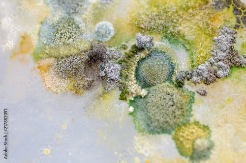 Backgrounds of Colony Characteristics of Fungus and algae in petri dish for education. photo