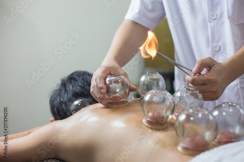 Traditional Chinese Medicine Treatment - Acupuncture photo