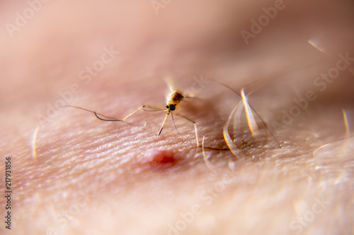 Close-up of mosquito sucking blood from human skin
