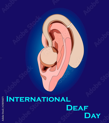International Day of the Deaf, the image of an ear with a hearing aid