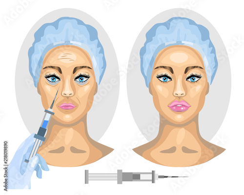 Cosmetic procedure concept. Woman face Before and after. Botox injection.