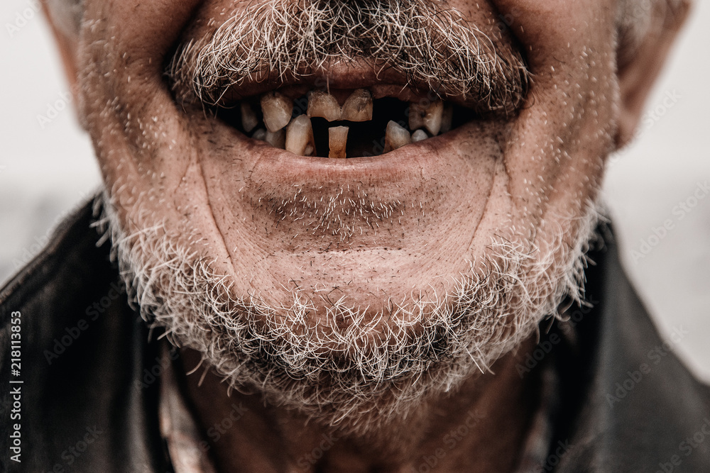 Old man without part of his teeth is smiling Stock Photo | Adobe Stock