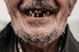 Old man without part of his teeth is smiling