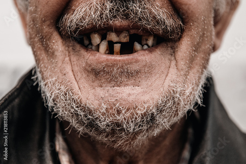 Canvas Print Old man without part of his teeth is smiling