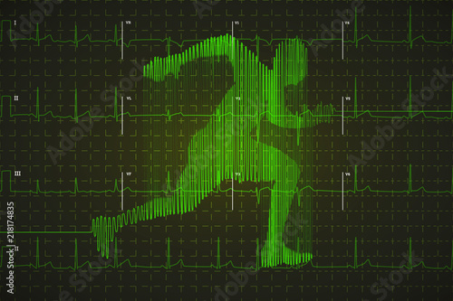 Bright green human electrocardiogram in running shape on dark monitor, healthy life concept