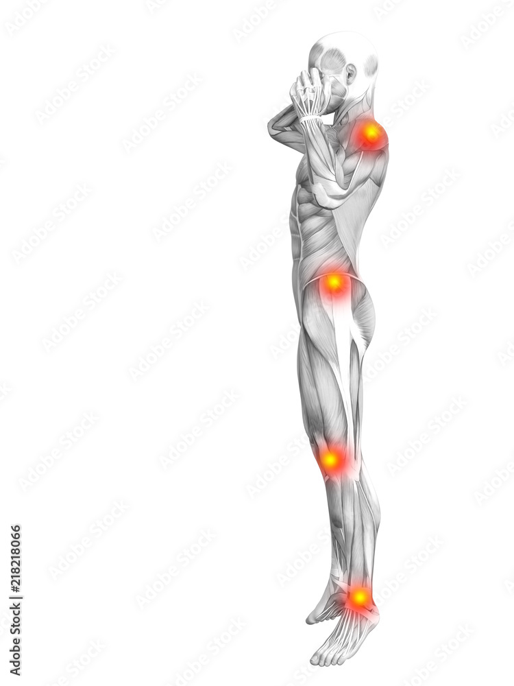 Conceptual human muscle anatomy with red and yellow hot spot inflammation or articular joint pain for health care therapy or sport concepts. 3D illustration man arthritis or bone osteoporosis disease Conceptual human muscle anatomy with red and yellow hot spot inflammation or articular joint pain for health care therapy or sport concepts. 3D illustration man arthritis or bone osteoporosis disease