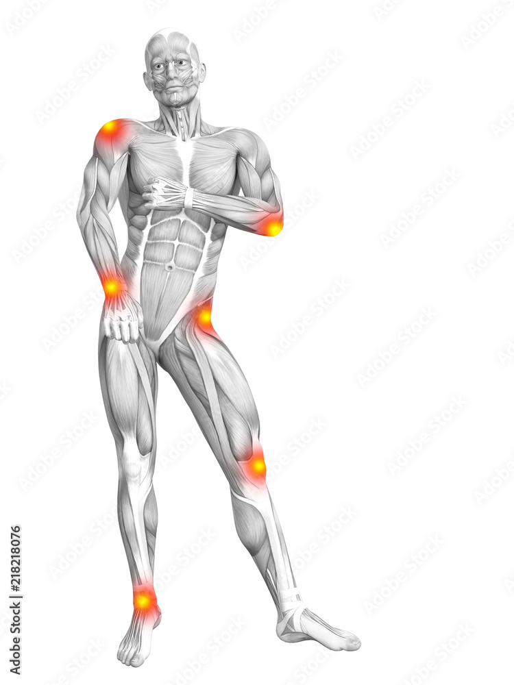 Conceptual human muscle anatomy with red and yellow hot spot inflammation or articular joint pain for health care therapy or sport concepts. 3D illustration man arthritis or bone osteoporosis disease Conceptual human muscle anatomy with red and yellow hot spot inflammation or articular joint pain for health care therapy or sport concepts. 3D illustration man arthritis or bone osteoporosis disease