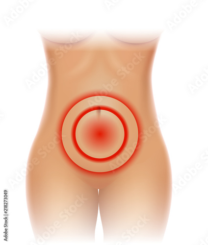 Female Pelvic pain, lower abdominal pain