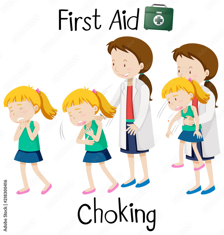 First aid for chocking First aid for chocking