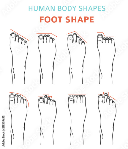 Human body shapes.Feet types icon set