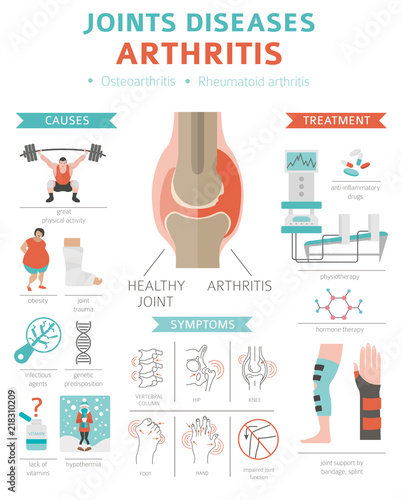 Joints diseases. Arthritis symptoms, treatment icon set. Medical infographic design