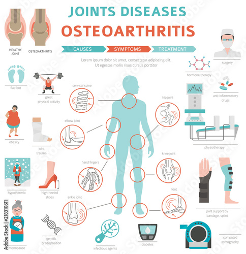 Joints diseases. Arthritis, osteoarthritis symptoms, treatment icon set. Medical infographic design