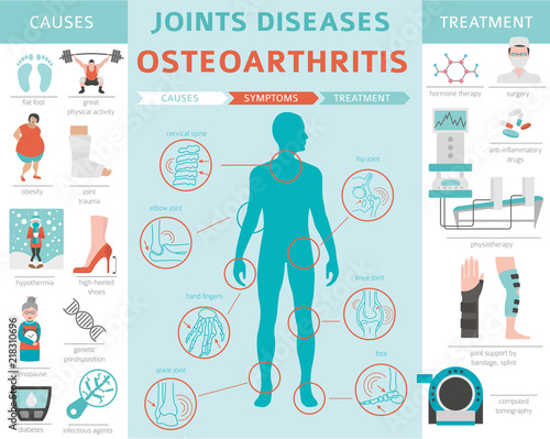Joints diseases. Arthritis, osteoarthritis symptoms, treatment icon set. Medical infographic design