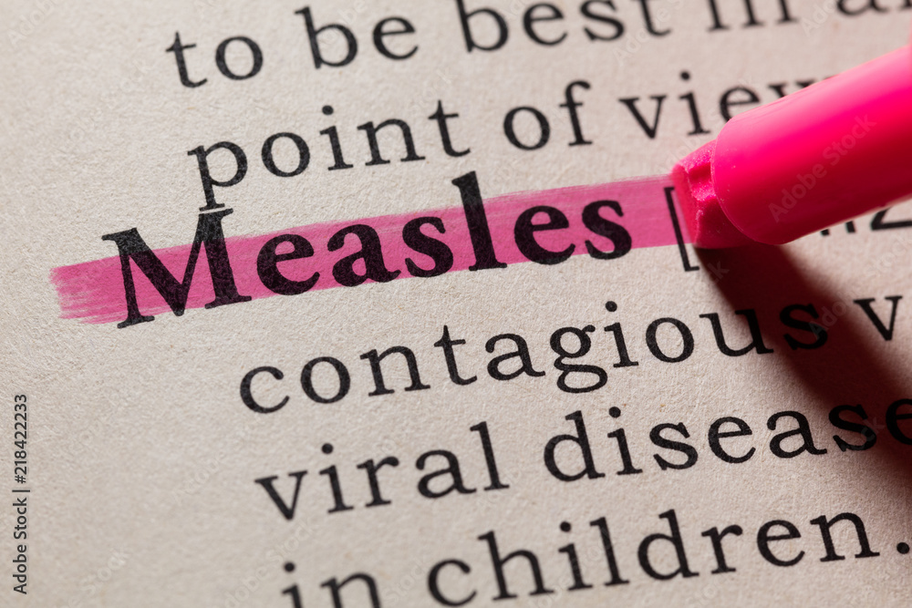 definition of measles - obrazy, fototapety, plakaty 
