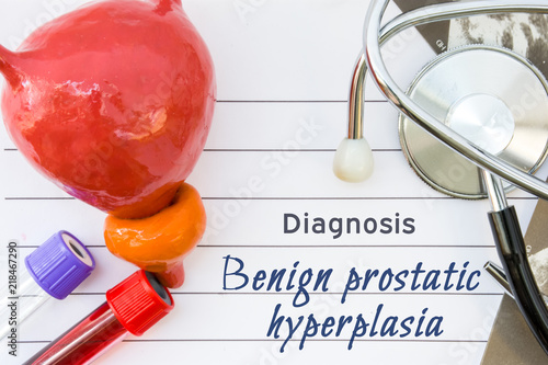 Diagnosis of Benign Prostatic Hyperplasia. Medical concept picture of prostate hyperplasia with  anatomical model of bladder with prostate, stethoscope, ultrasound result and laboratory test tube 