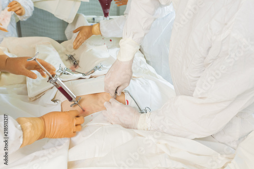 Fotografia bone marrow transplant operation