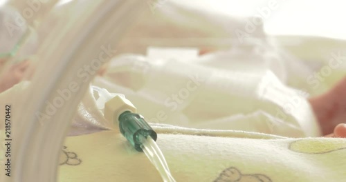 Small baby newborn at hospital in incubator Neonatology,Cared for by a doctor neonatologist and nurse. Medical devices cardiogram cannula tube.