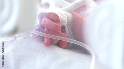 Little feet and hand a newborn baby and newborn babies sleepiing at nursery  at the hospital, focus Neonatology,Cared for by a doctor neonatologist and nurse. Medical devices cardiogram cannula tube. photo