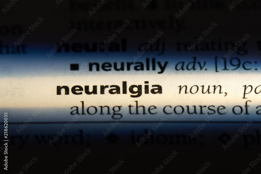 neuralgia neuralgia