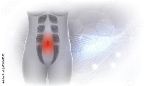 Diastasis Recti also known as Diastasis Rectus Abdominus or abdominal separation, it is common among pregnant women and post birth. There is a gap between the rectus abdominis muscles.