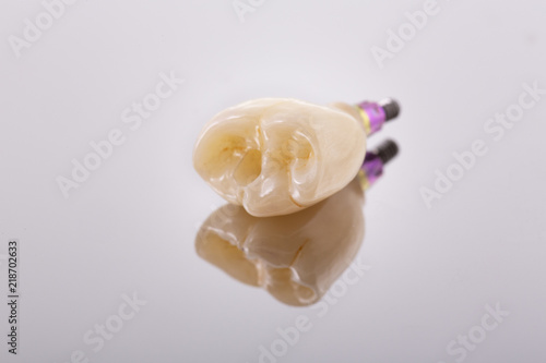Tooth human implant. Dental concept. Ceramic human teeth or dentures. Implants on mirror background closeup