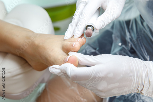 Medical pedicure for a woman