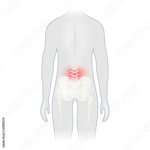 Back pain