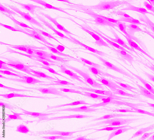 Fibroblast cells mebrane labeled with fluorescent dye