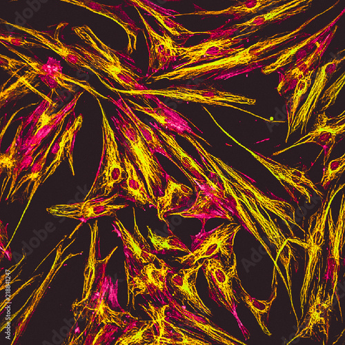 Confocal microscopy of fibroblast cells