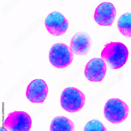Human acute leukemia cell line