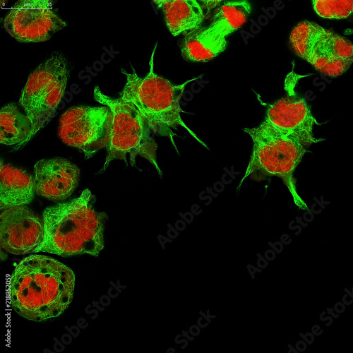 Obraz na plátne Real fluorescence microscopic view of human neuroblastoma cells