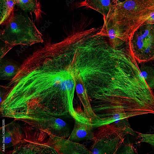 Confocal microscopy of fibroblast cells