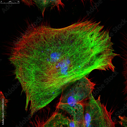 Confocal microscopy of fibroblast cells