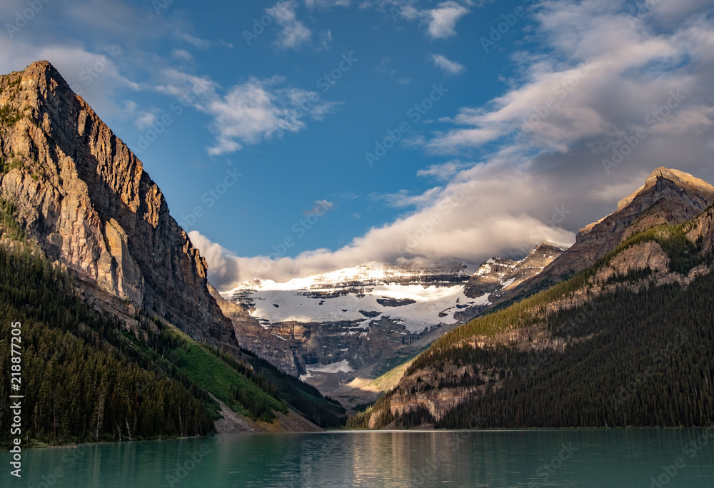 Lake Louise View 14